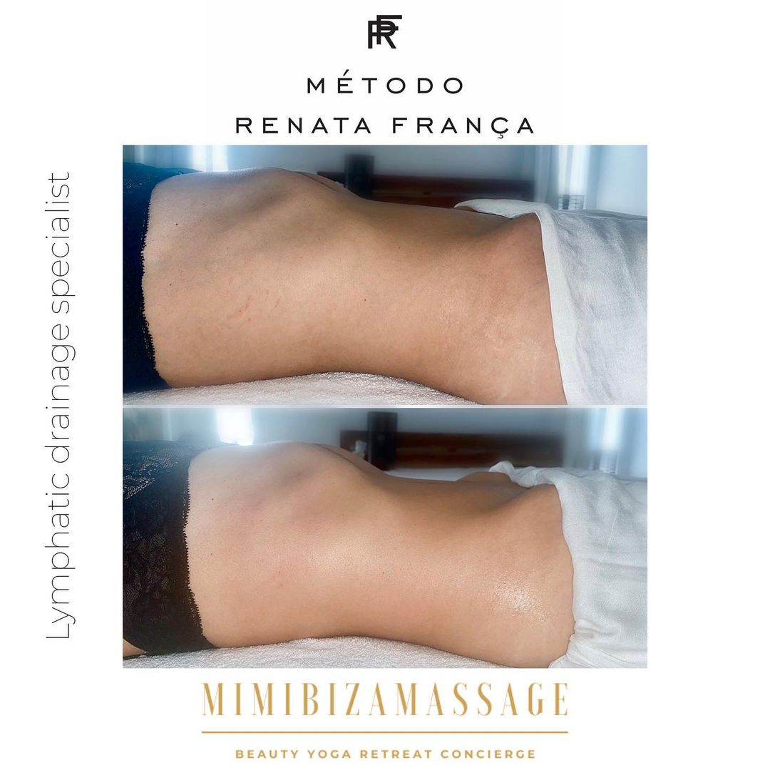 Renata França Method Ibiza lymphatic drainage massage for summer body preparation