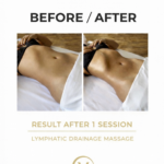 Renata França lymphatic drainage massage in Ibiza villa