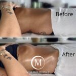 renata-franca-lymphatic-massage-ibiza.jpg.