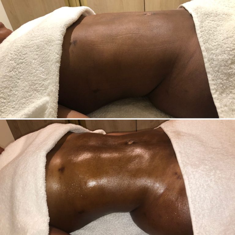 masaje de drenaje linfático en Ibiza villa tratamiento de spa móvil